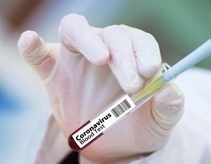 Koronavírus-teszteket is fog gyártani Magyarországon egy izraeli vállalat